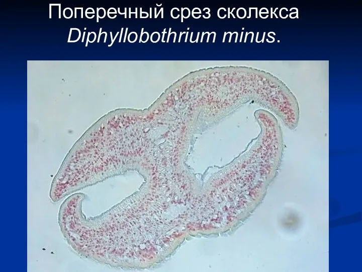 Поперечный срез сколекса Diphyllobothrium minus.