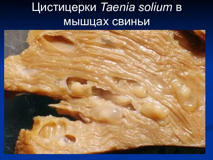 Цистицерки Taenia solium в мышцах свиньи