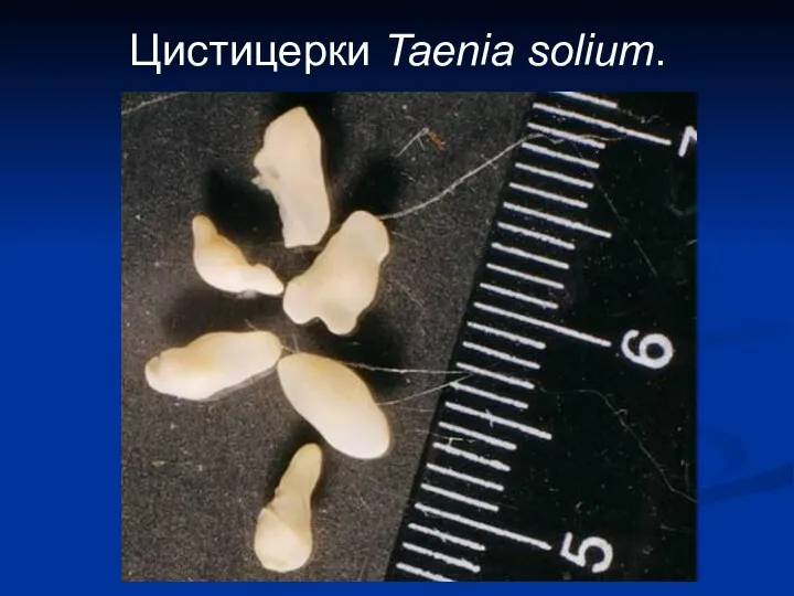 Цистицерки Taenia solium.