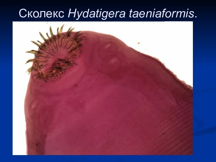 Сколекс Hydatigera taeniaformis.