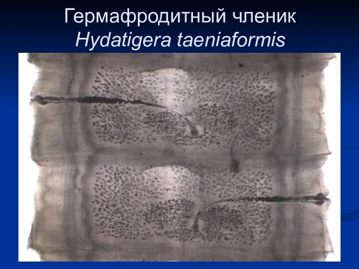 Гермафродитный членик Hydatigera taeniaformis