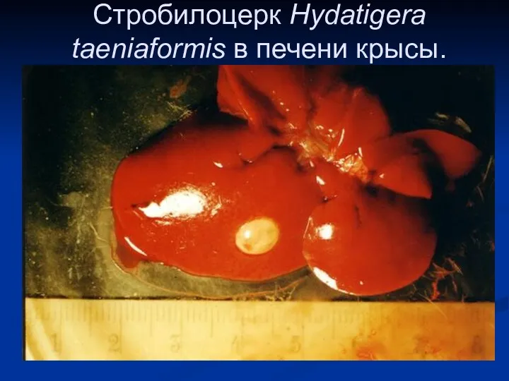 Стробилоцерк Hydatigera taeniaformis в печени крысы.