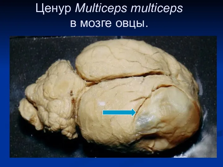 Ценур Multiceps multiceps в мозге овцы.