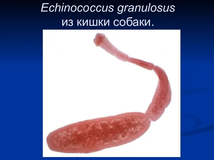 Echinococcus granulosus из кишки собаки.
