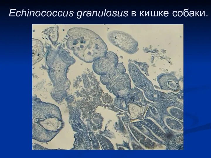 Echinococcus granulosus в кишке собаки.