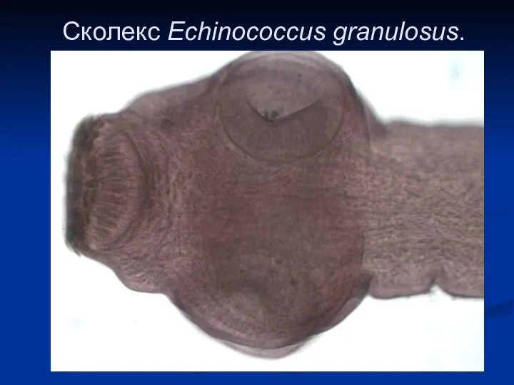 Сколекс Echinococcus granulosus.