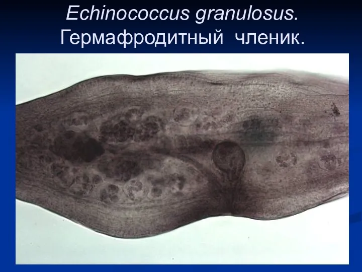 Echinococcus granulosus. Гермафродитный членик.