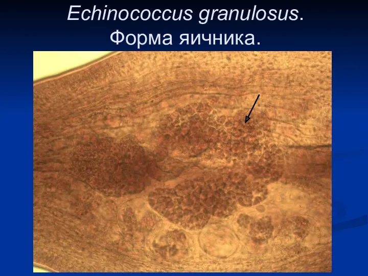 Echinococcus granulosus. Форма яичника.