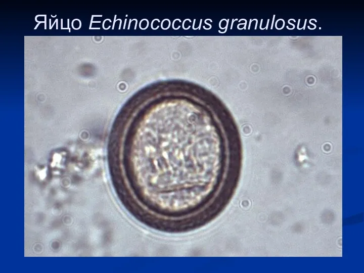 Яйцо Echinococcus granulosus.