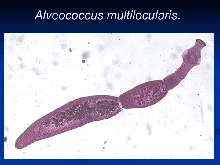 Alveococcus multilocularis.
