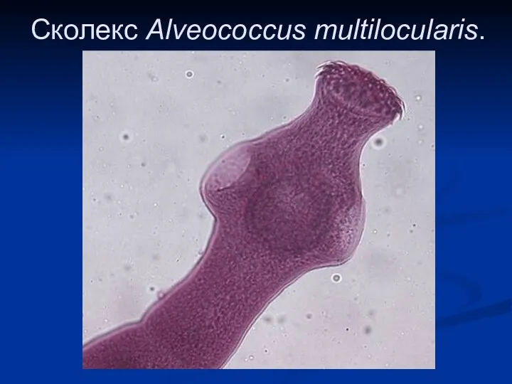 Сколекс Alveococcus multilocularis.