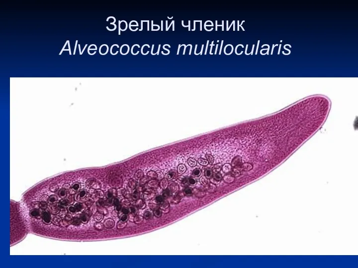 Зрелый членик Alveococcus multilocularis