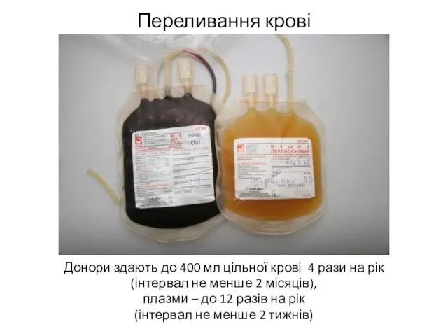 Переливання крові Донори здають до 400 мл цільної крові 4