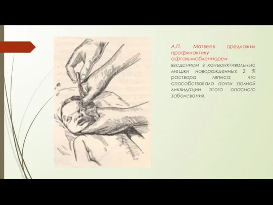 А.П. Матвеев предложил профилактику офтальмобленнореи введением в конъюнктивальные мешки новорожденных