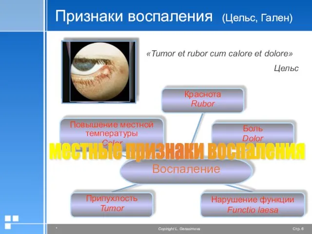 Признаки воспаления (Цельс, Гален) «Tumor et rubor cum calore et dolore» Цельс местные признаки воспаления