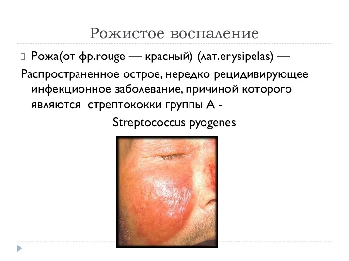 Рожистое воспаление Рожа(от фр.rouge — красный) (лат.erysipelas) — Распространенное острое,