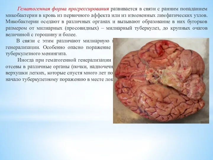 Гематогенная форма прогрессирования развивается в связи с ранним попаданием микобактерии