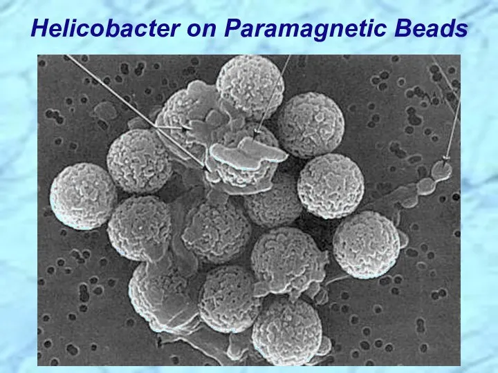 Helicobacter on Paramagnetic Beads