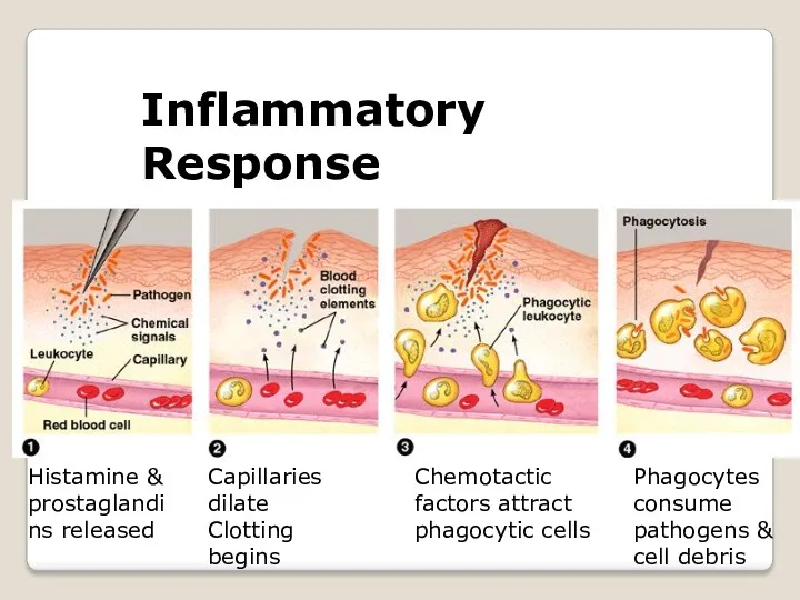 Inflammatory Response Histamine & prostaglandins released Capillaries dilate Clotting begins