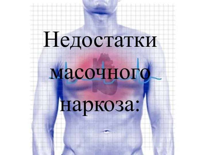 Недостатки масочного наркоза: