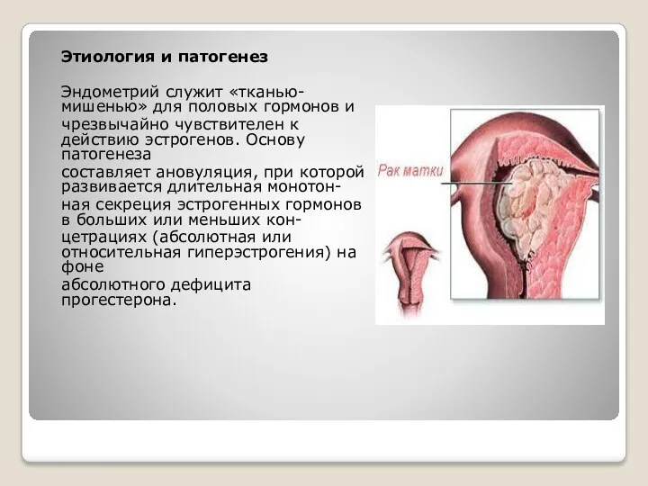 Этиология и патогенез Эндометрий служит «тканью-мишенью» для половых гормонов и