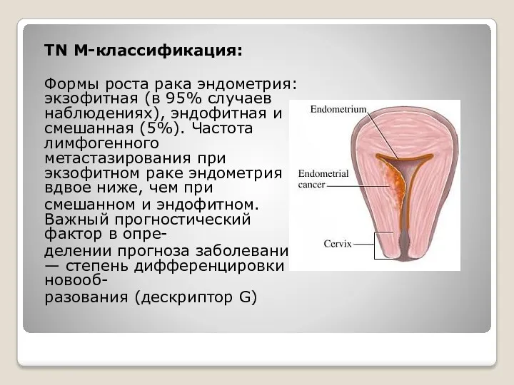 TN М-классификация: Формы роста рака эндометрия: экзофитная (в 95% случаев