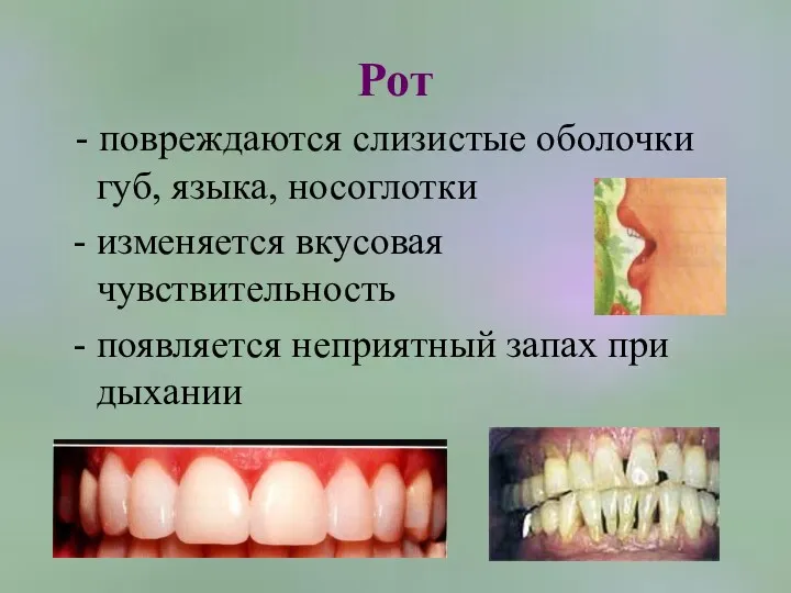 Рот - повреждаются слизистые оболочки губ, языка, носоглотки изменяется вкусовая чувствительность появляется неприятный запах при дыхании