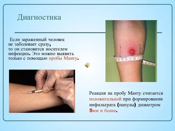 Диагностика Если зараженный человек не заболевает сразу, то он становится