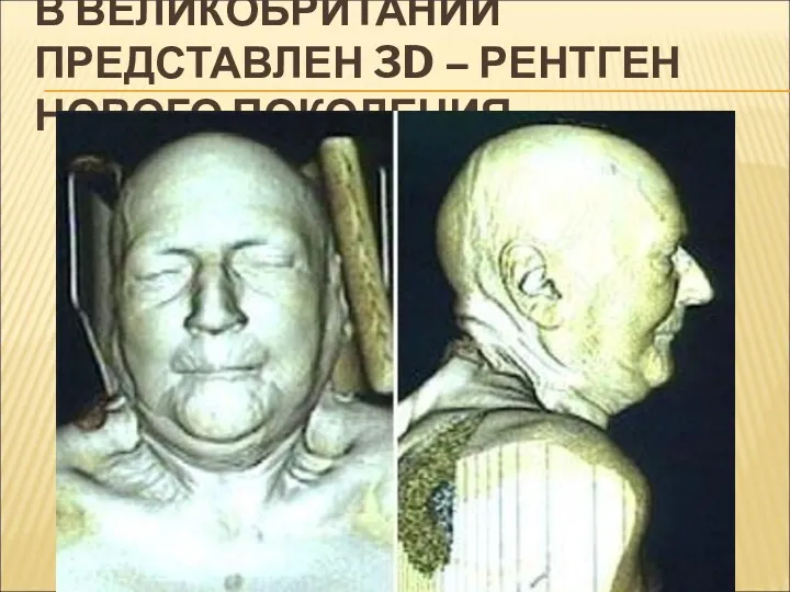 В ВЕЛИКОБРИТАНИИ ПРЕДСТАВЛЕН 3D – РЕНТГЕН НОВОГО ПОКОЛЕНИЯ