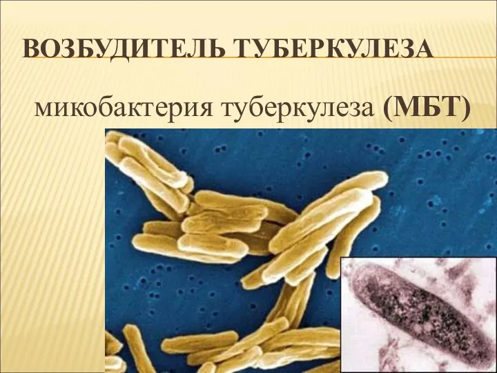 ВОЗБУДИТЕЛЬ ТУБЕРКУЛЕЗА микобактерия туберкулеза (МБТ)