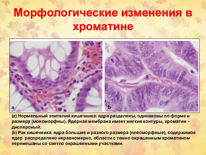 Морфологические изменения в хроматине (a) Нормальный эпителий кишечника: ядра разделены,