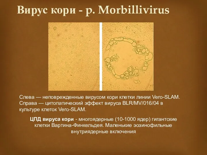 Вирус кори - p. Morbillivirus Слева — неповрежденные вирусом кори