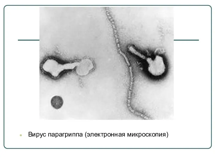 Вирус парагриппа (электронная микроскопия)