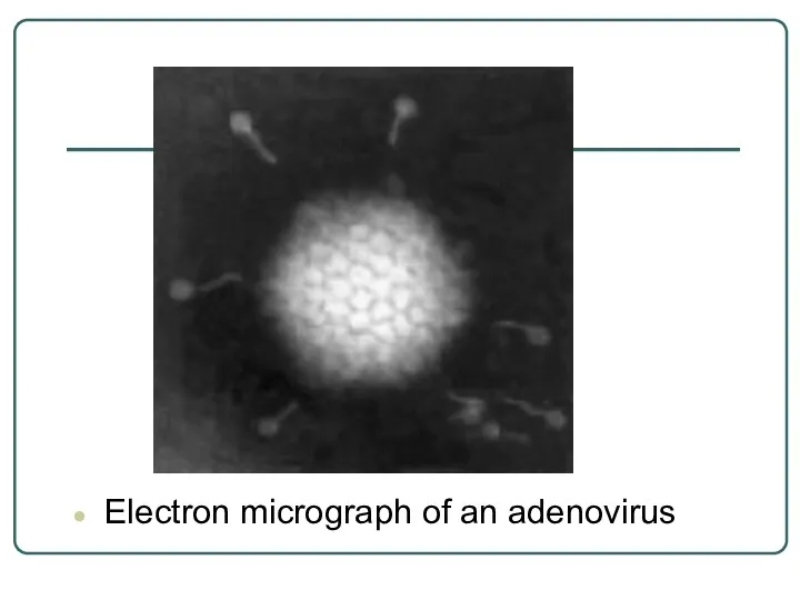 Electron micrograph of an adenovirus