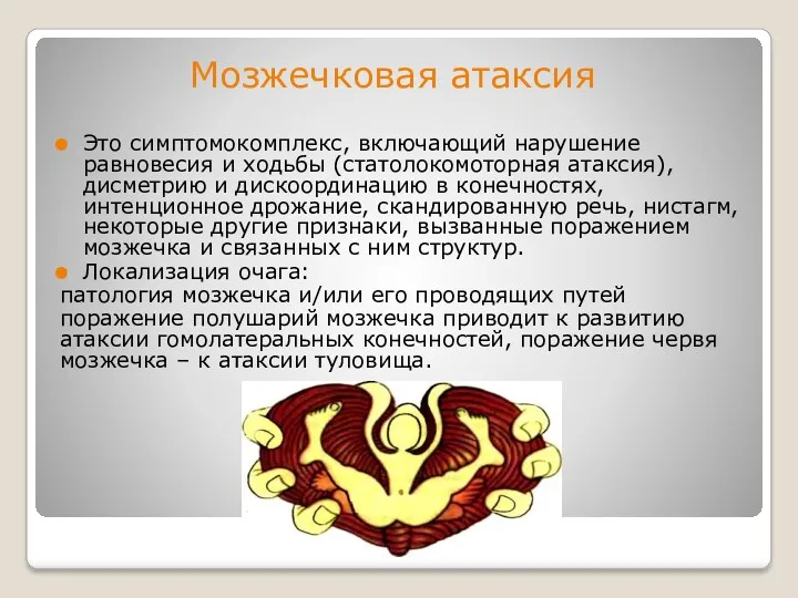 Мозжечковая атаксия Это симптомокомплекс, включающий нарушение равновесия и ходьбы (статолокомоторная