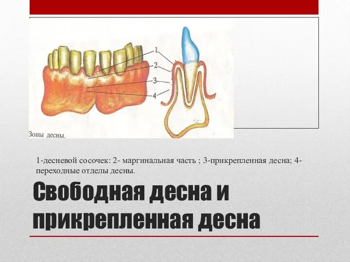 Свободная десна и прикрепленная десна 1-десневой сосочек: 2- маргинальная часть