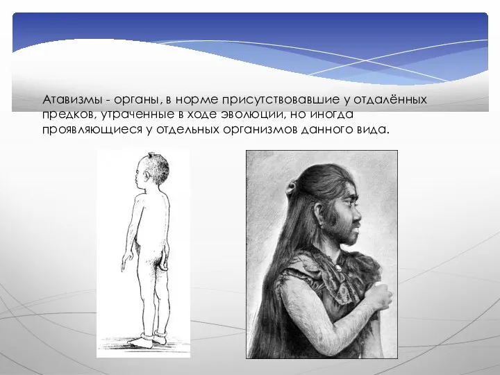 Атавизмы - органы, в норме присутствовавшие у отдалённых предков, утраченные