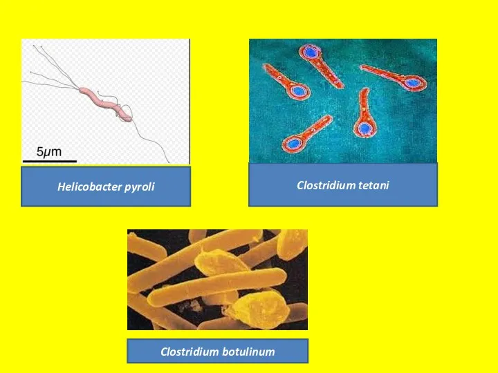 Helicobacter pyroli Clostridium tetani Clostridium botulinum