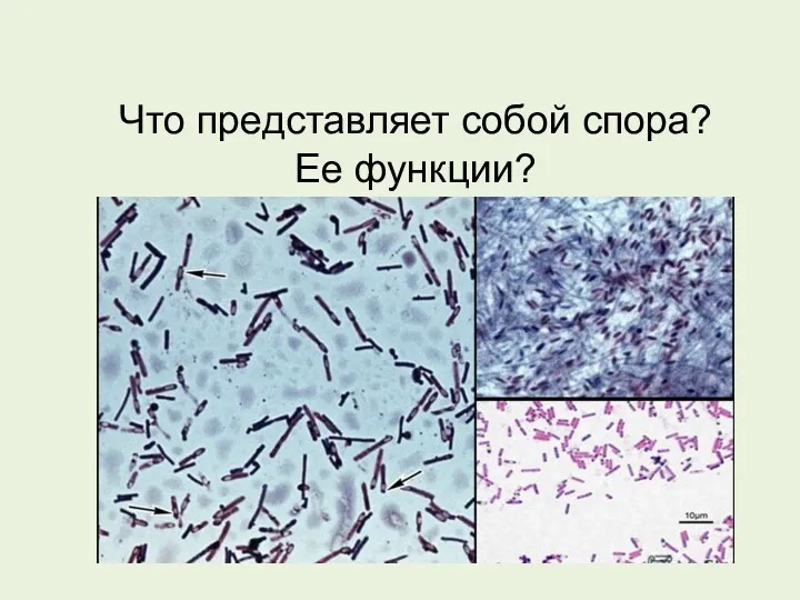 Что представляет собой спора? Ее функции?