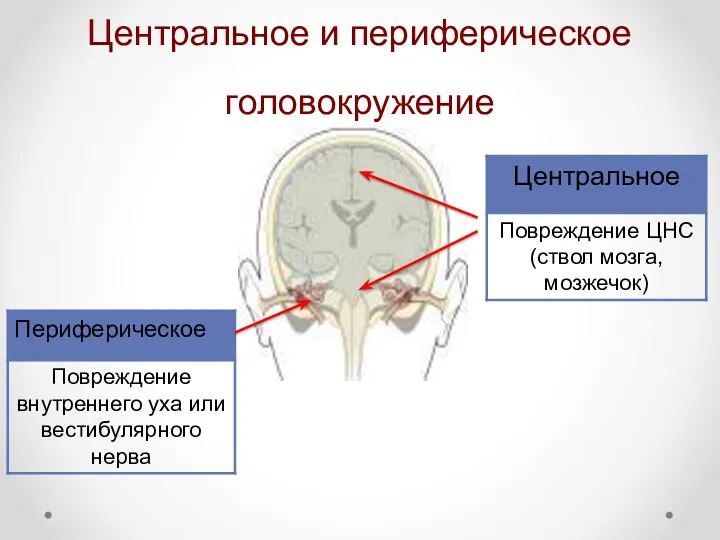 Центральное и периферическое головокружение