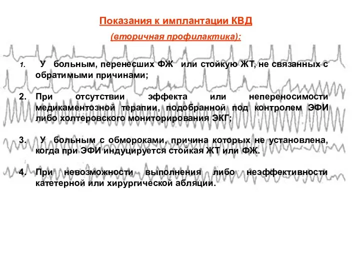 Показания к имплантации КВД (вторичная профилактика): У больным, перенесших ФЖ