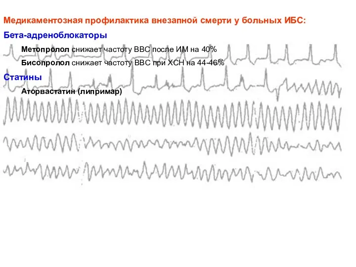 Медикаментозная профилактика внезапной смерти у больных ИБС: Бета-адреноблокаторы Метопролол снижает