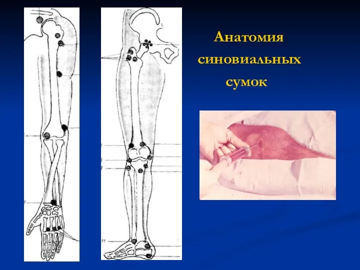 Анатомия синовиальных сумок