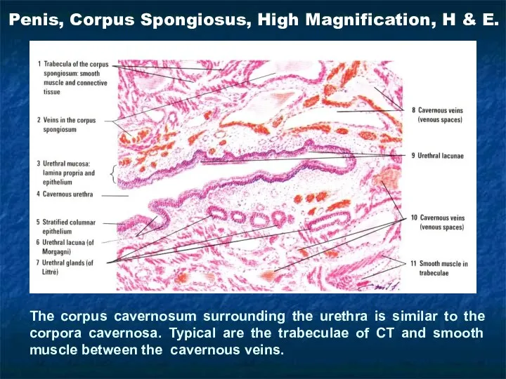The corpus cavernosum surrounding the urethra is similar to the corpora cavernosa. Typical