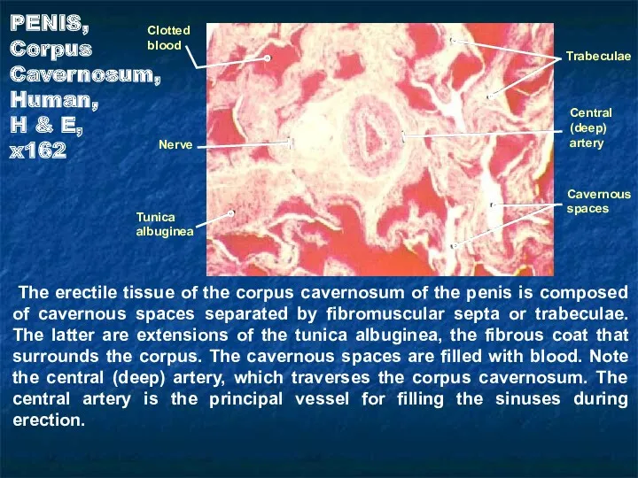 The erectile tissue of the corpus cavernosum of the penis is composed of