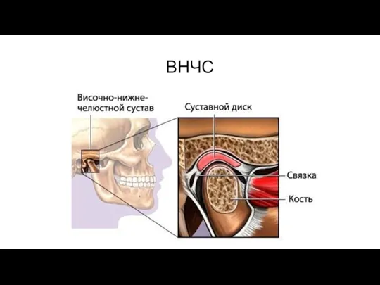 ВНЧС