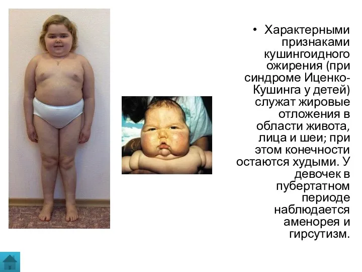 Характерными признаками кушингоидного ожирения (при синдроме Иценко-Кушинга у детей) служат