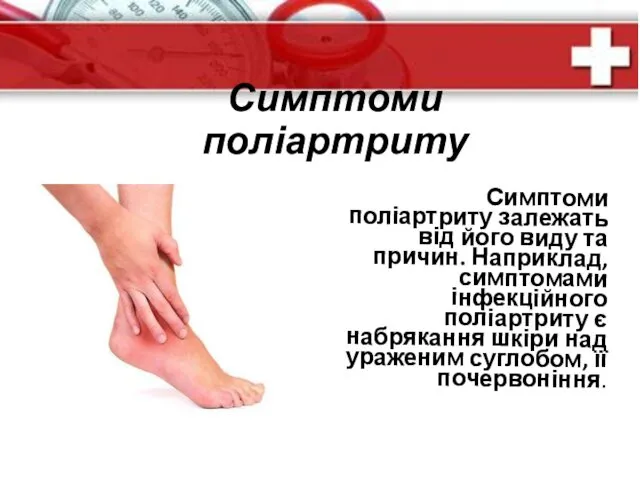 Симптоми поліартриту Симптоми поліартриту залежать від його виду та причин.