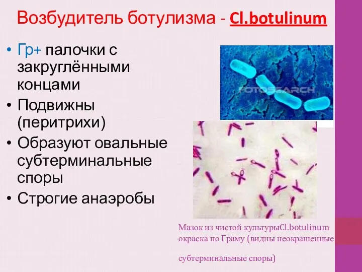 Мазок из чистой культурыCl.botulinum окраска по Граму (видны неокрашенные субтерминальные