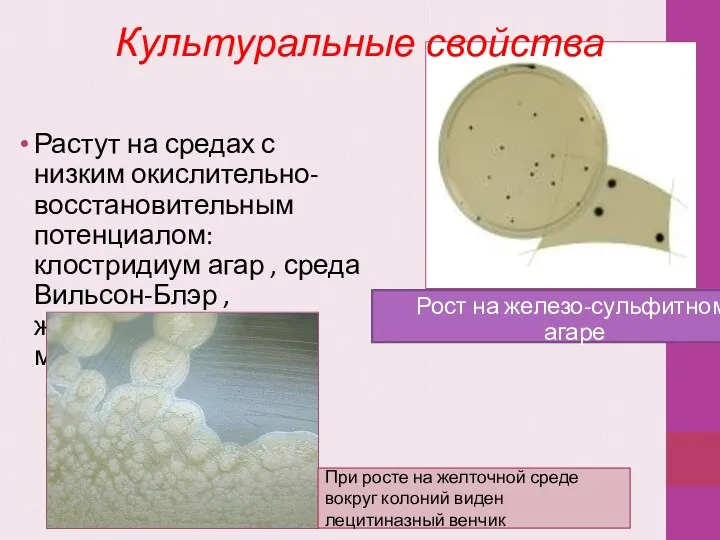 Растут на средах с низким окислительно-восстановительным потенциалом: клостридиум агар ,